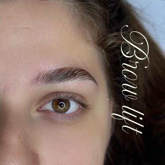 Anova Aesthetics #zagreb Trepavice Brow lift