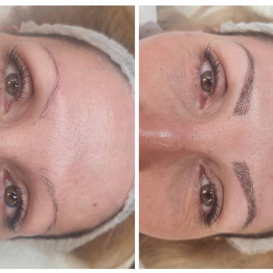 Cosmoderm & Centar Estetica usluga