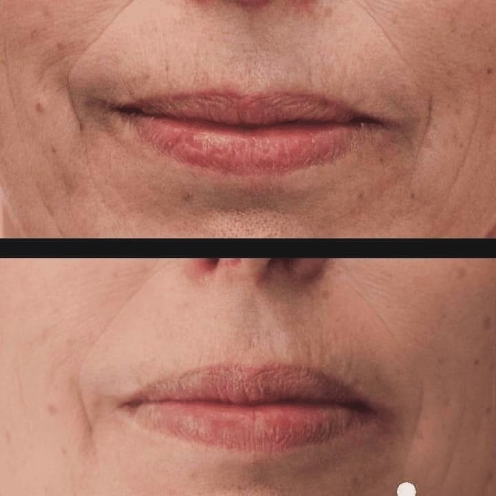 Antiage beauty room Lady Goga #zagreb Tretman lica