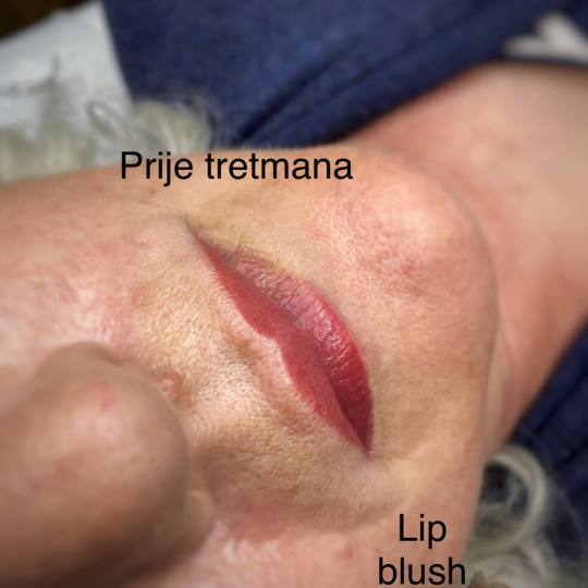 Anova Aesthetics usluga