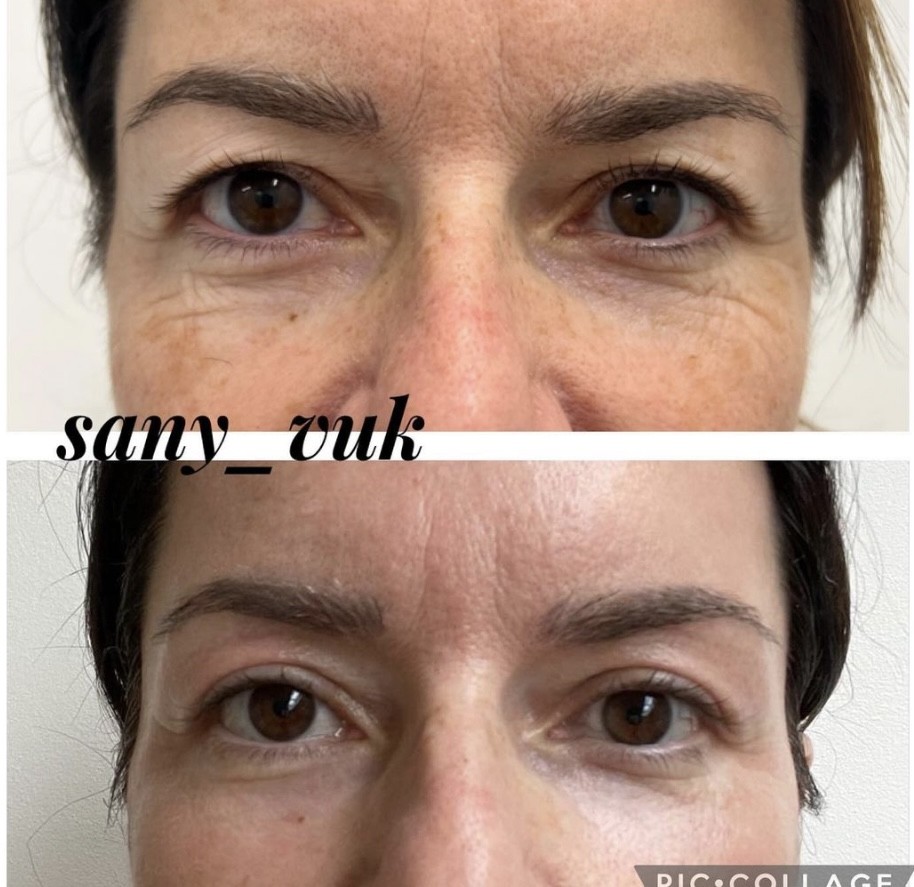 Sany Nails & Cosmetics #zagreb Tretman lica