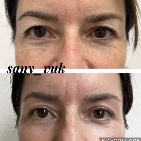 Sany Nails & Cosmetics #zagreb Tretman lica  ACCOR Cosmetics Corrector je nježna alternativa operac