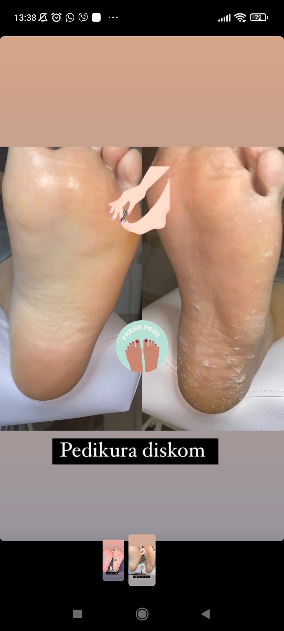 Lash and Brow studio #rogoznica Masaža teglama pedikura suha aparatna ( ruska )