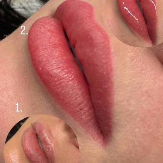 MOELL beauty #zagreb Trajna šminka Mikropigmentacija usana /Lip blush