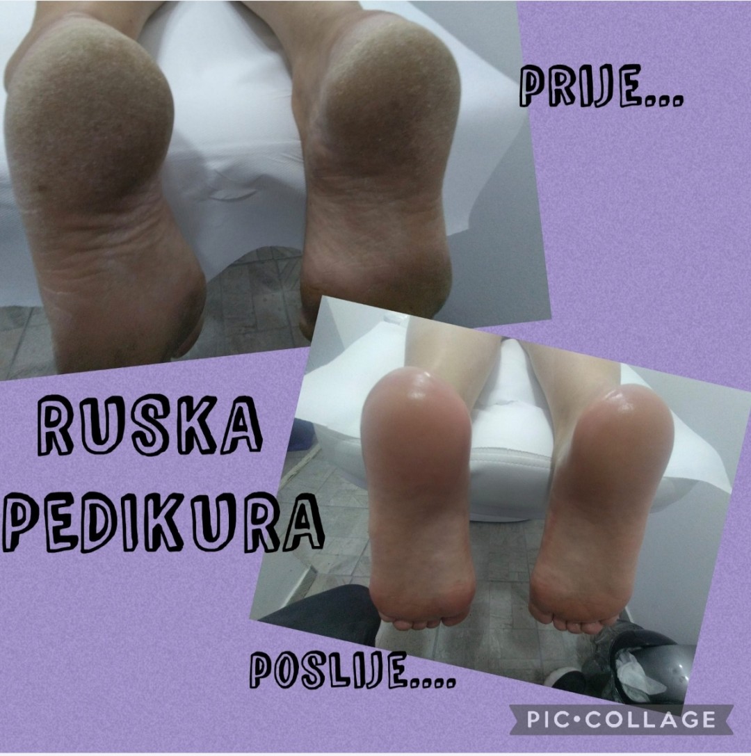 Jonno Nails #zagreb Estetska pedikura Ruska pedikura- estetska, NE MEDICINSKA