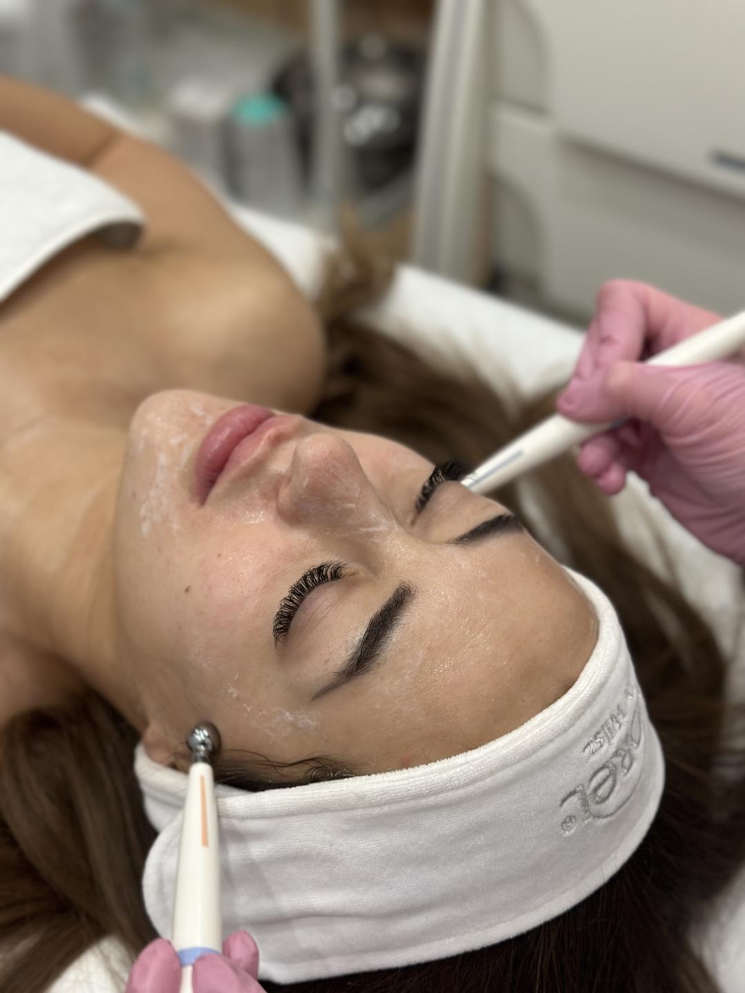 Mikrostruje lica - Beauty Box - Zagreb, Zagreb Tretman lica Lice Tretman lica, Zagreb, Maksimir