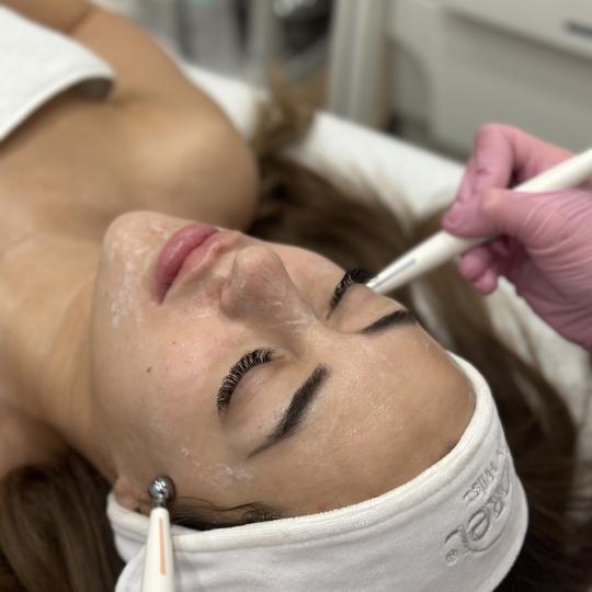 Beauty Box - Zagreb #zagreb Tretman lica Mikrostruje lica